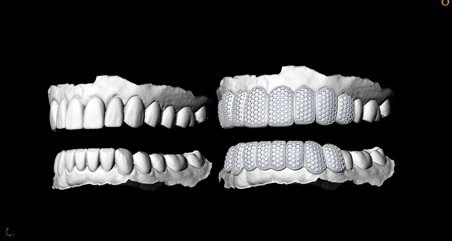 White Gold Honeycomb Setting Diamond Iced Out Grills